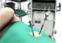 Hip Arthroscopy